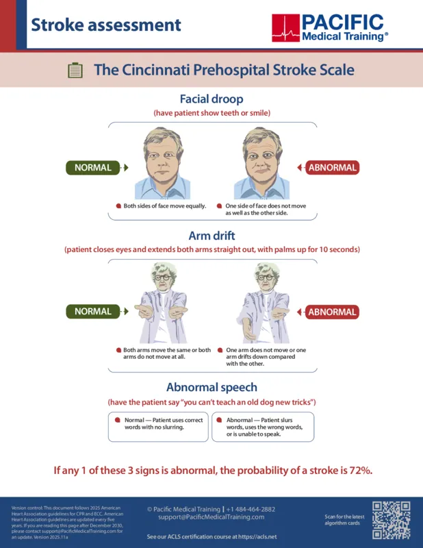 ACLS suspected stroke algorithm: Managing acute ischemic stroke PDF preview