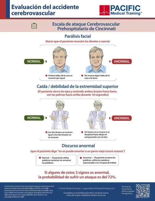 Algoritmo de sospecha de accidente cerebrovascular ACLS